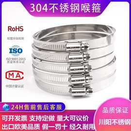 304不锈钢喉箍安防监控卡箍煤气管卡夹管箍美式喉箍抱箍管箍