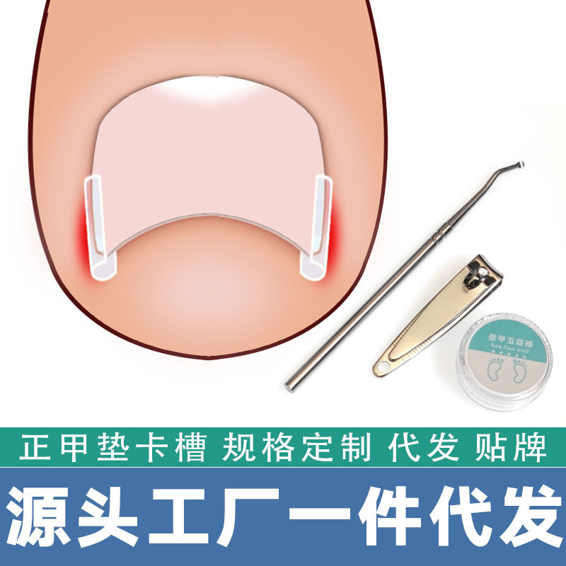 Nail Pad Nail Groove Inlay Nail Corrector Nail Pad Roll Nail Corrector Pull and Stick Toenail Long into Meat
