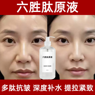 �����Ŀ������AҺ�����o��ȥ̧�^�y����y������ȥ���ഺ����ԭҺ