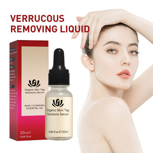 Wart Removal�o���c���뾫��Һ����Ƥ�w���������������뾫��