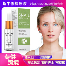 羳΁ţԭҺޏ;A Snail Serum΁ţޏԭҺ沿oԭҺ