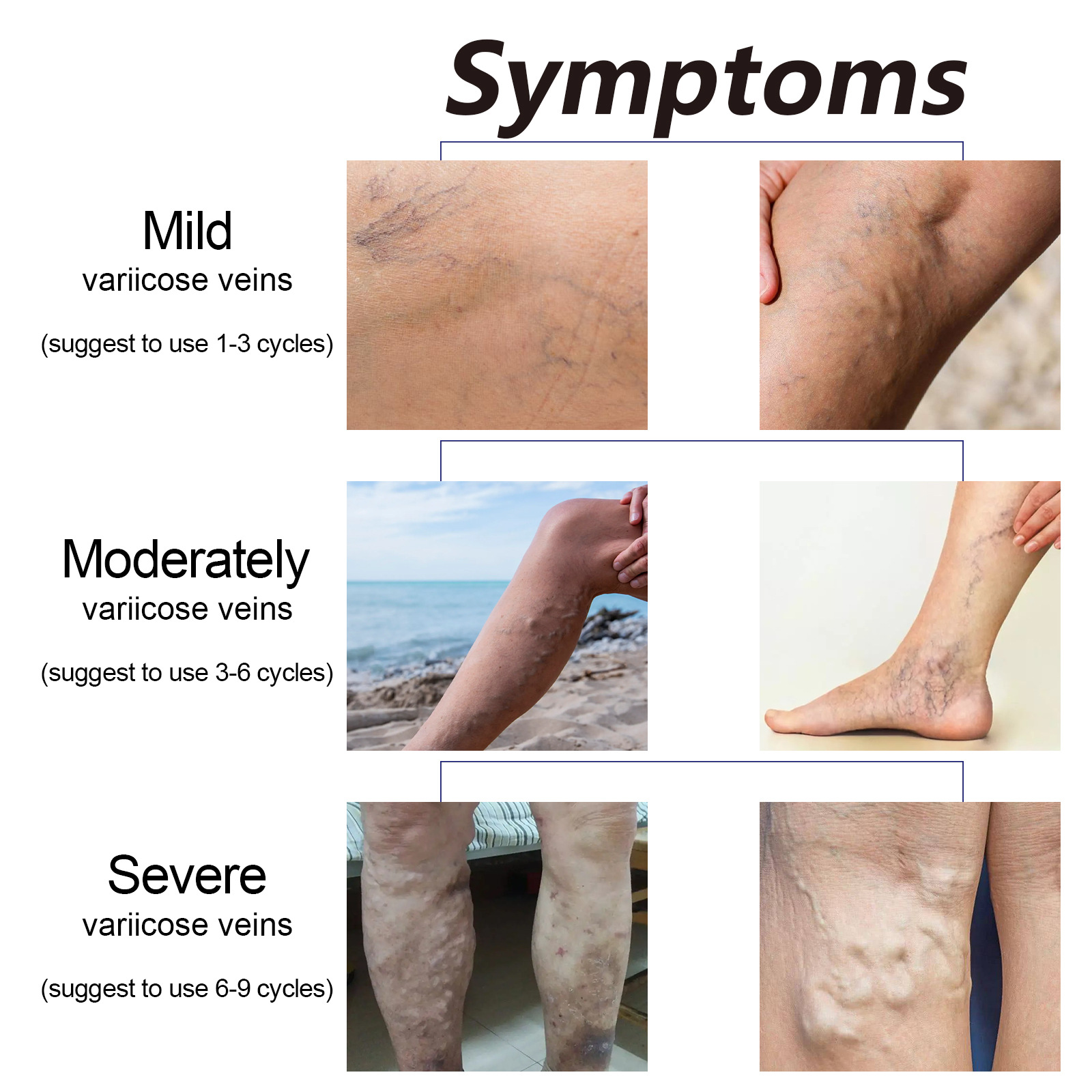 10 ml kummel eeterliku õli kehahoolduskomplekt lõõgastumiseks ja nahaks