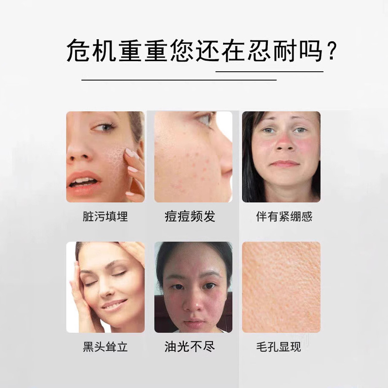 叙利亚十二年窖藏古皂橄榄油月桂油幼儿孕妇洁面控油黑头除螨祛痘|undefined