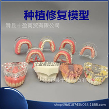 ����ģ�Ϳ�ǻ��ֲģ����ֲ���˵����޸��Ա���ֲ����ñ�˿�����