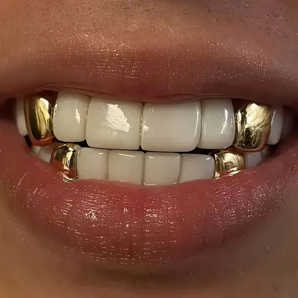 Europe and the United States hot vampire fangs personality golden single braces hip-hop men's nightclub features teeth decoration manufacturers wholesale