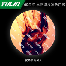 �۷�Ĥ���bƬ��У�t�WԺУ�ýM������ʯϞ��Ƭ�˱��@΢�R