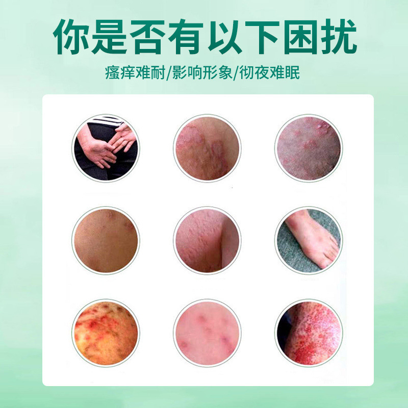 徐御堂七草大夫泰国虎毒膏止痒抑菌护肤皮肤瘙痒外用厂家批发|undefined