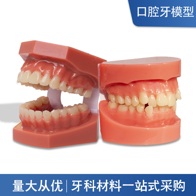 Modelo dental, modelo de corrección de demostración de mandíbula incorrecta, práctica de dentista, modelo de brackets pegajosos, molde de enseñanza de corrección