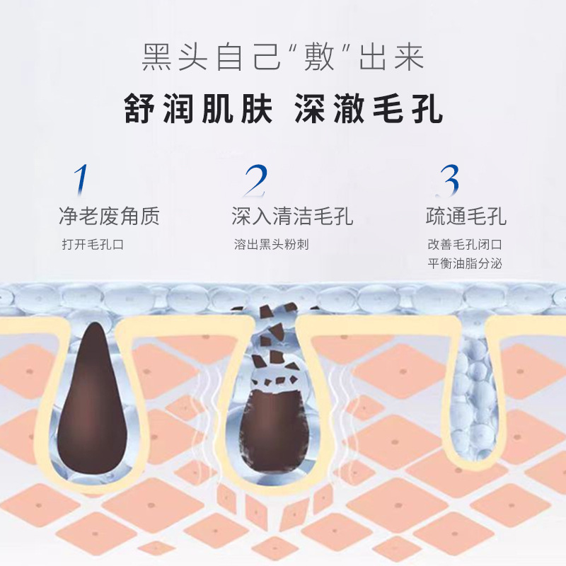 美容院專供去黑頭清潔收縮毛孔小氣泡白頭粉刺果酸T區黑頭導出液