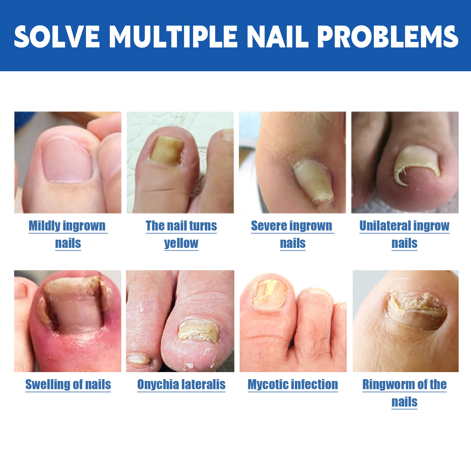 Nail Care Patch Image 8