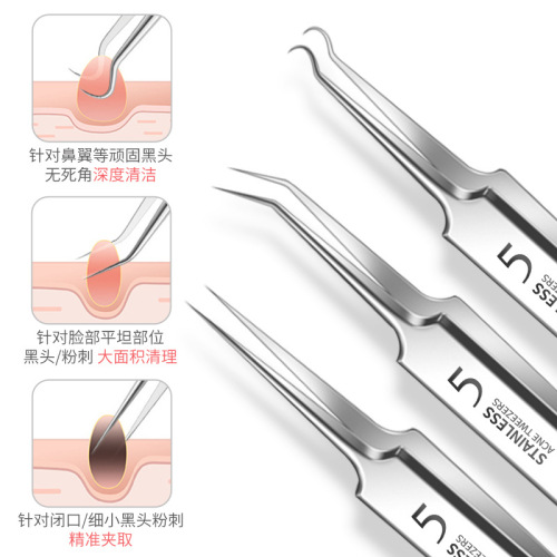 Stainless steel acne clip, cell clip, blackhead clip, acne needle set, acne and acne beauty tools manufacturer wholesale