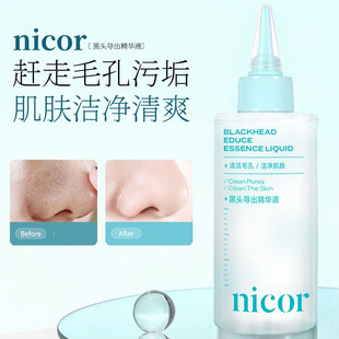 Popular Nicor ​​Blackhead Exporting Essence 150ml Cleans Pores, Cleans Skin, Cleans Pores, Cleanses and Refreshes Hair