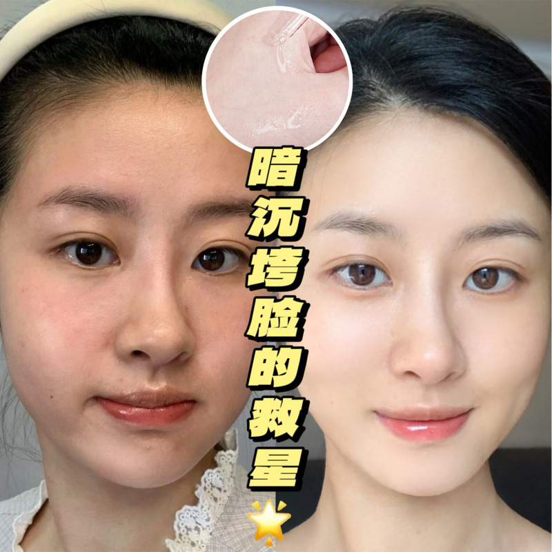 Su Xiuchen の 5% 高濃度トロンビン酸エッセンスは、保湿と若返り、くすみの改善、水分補給と保湿に役立ちます。|undefined