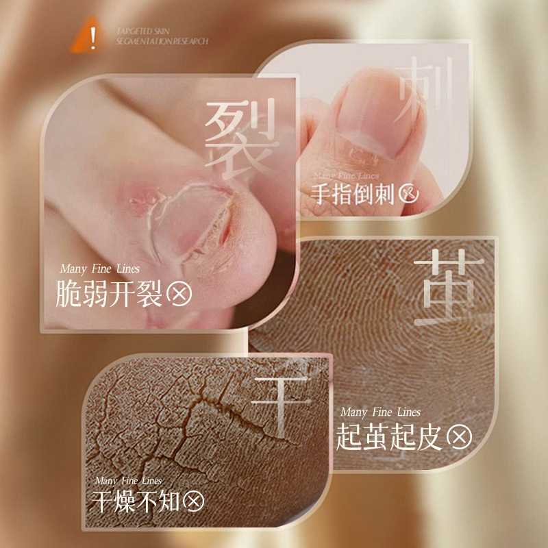 素秀臣氏德国维E马油膏滋养肌肤防干裂起皮粗糙补水细腻肌肤保湿|undefined