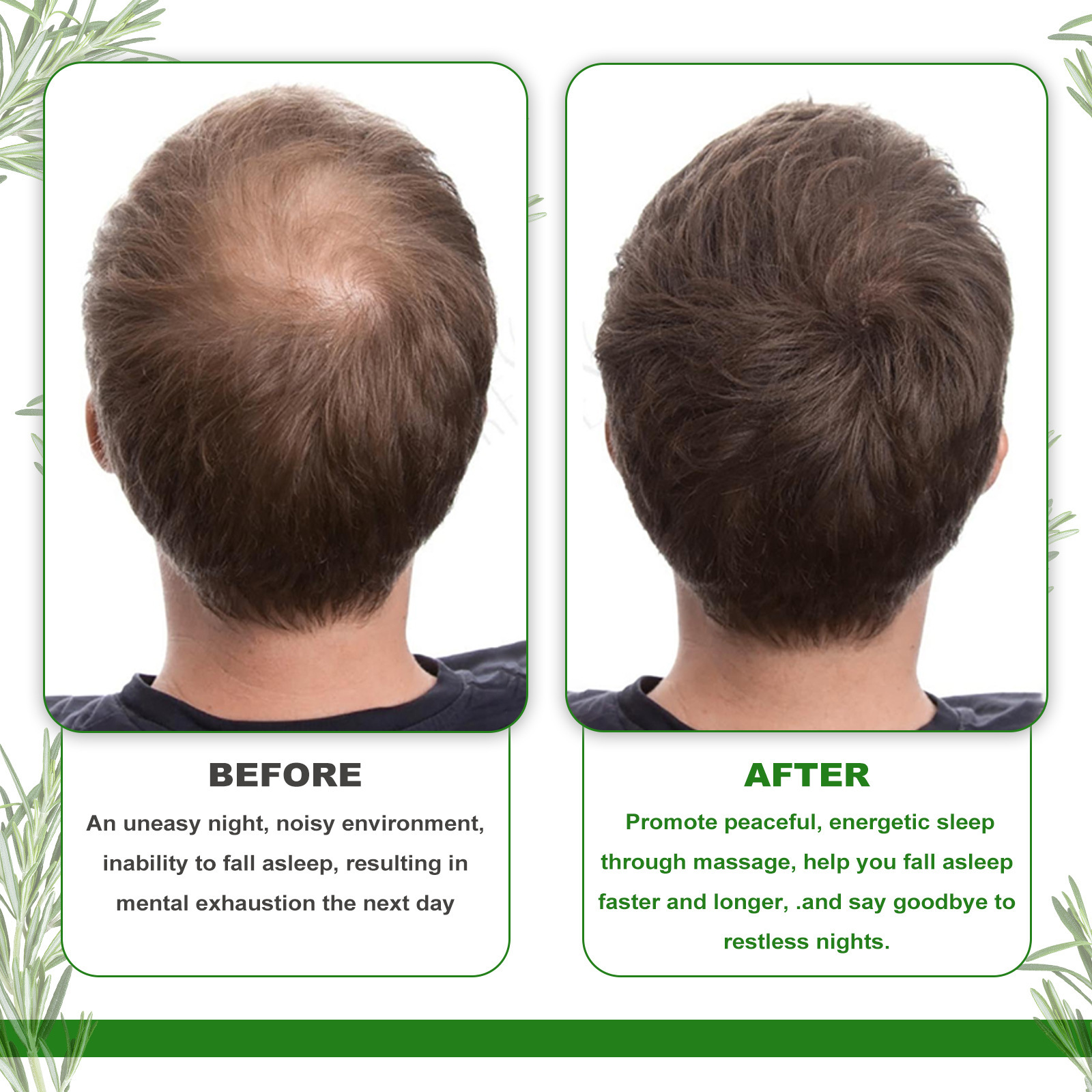 Olejek EELHOE z rozmarynu naprawia zniszczone włosy, wzmacnia, ujędrnia, zmiękcza i chroni włosy_voghion.com