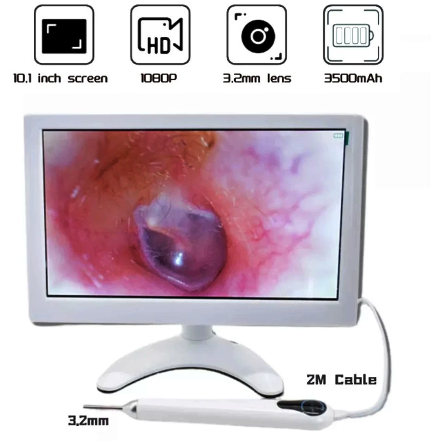Отоскоп 3,2 мм диаметром 10 дюймов монитор визуальный инструмент обучения ушам Проводной отоскоп с подставкой