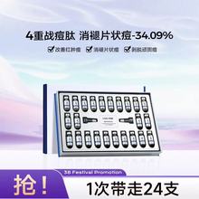 官方正品优理氏冻干粉正品祛痘淡红血丝淡化黑色素现货批发