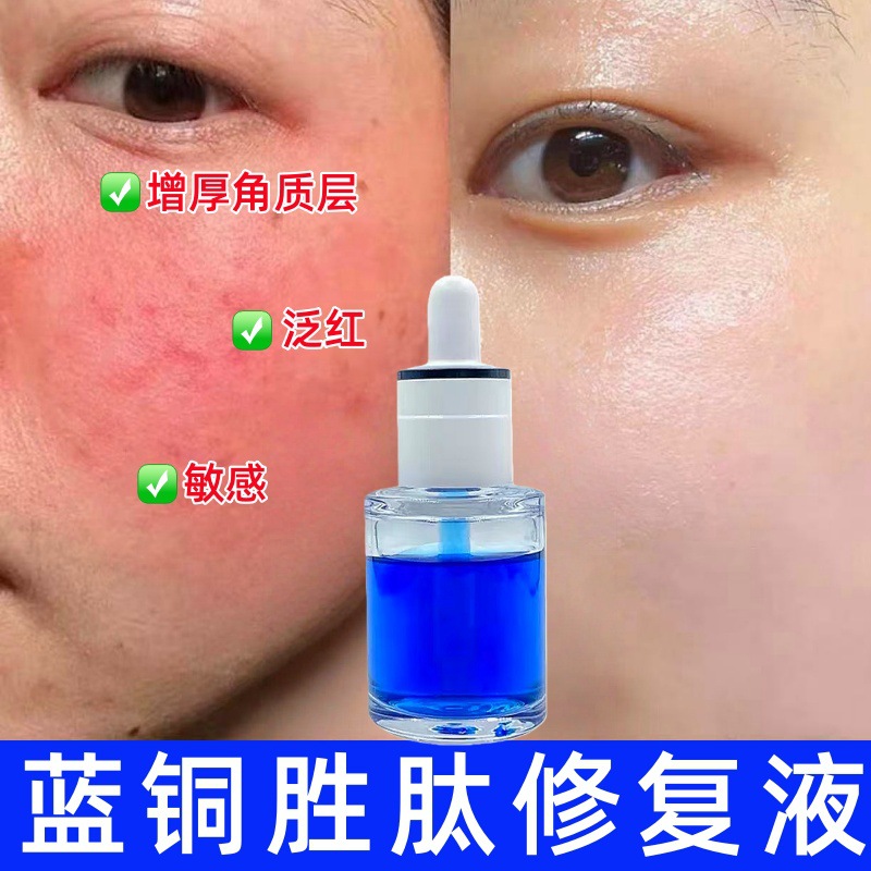 蓝铜胜肽修复液增厚角质层修护敏感肌祛斑后脸红脸干痒修复产品
