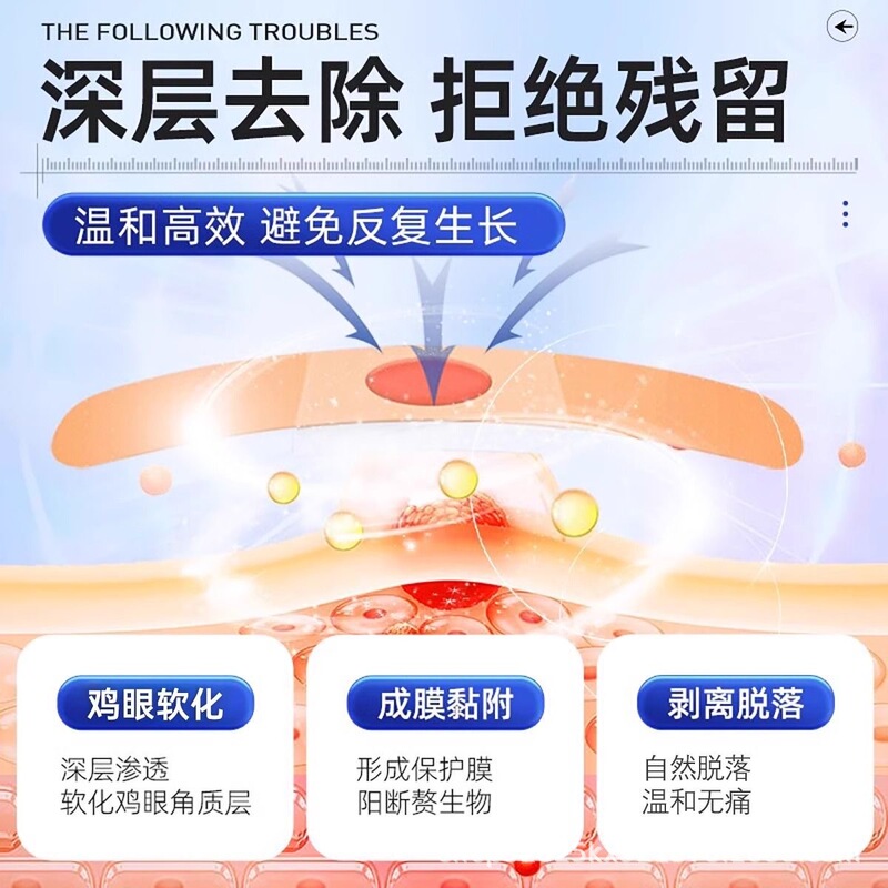海氏海诺鸡眼贴老茧脚茧鸡眼膏足部护理鸡眼护理盒修护|undefined