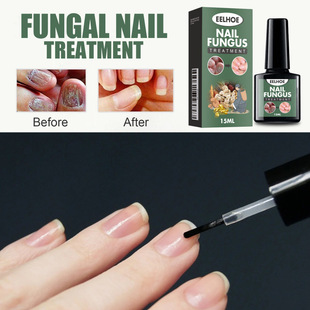 EELHOE Hand and Foot Onychomycosis Manicure Liquid Hand and Foot Onychomycosis Manicure Repair Manicure Thick Soft Nail Liquid