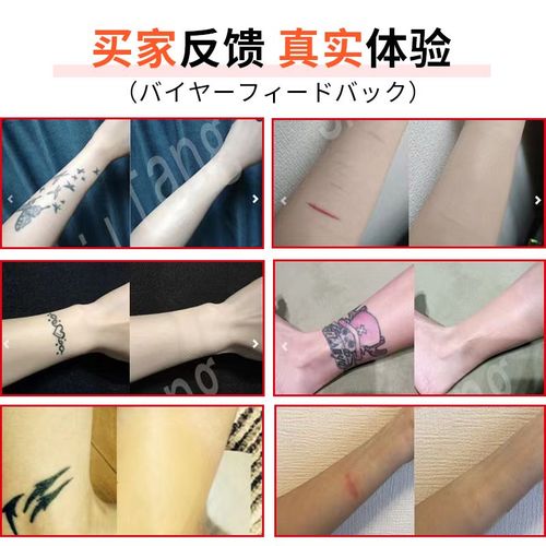 Tattoo cover-up, long-lasting flesh-colored waterproof scar invisible patch, artifact concealer, white spot birthmark tear-off fake skin