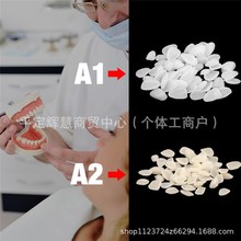 牙科材料牙贴面 牙片 A1色 A2色 临时冠 临时贴面 贴片 齿科材料