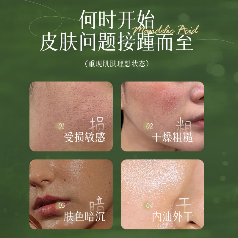 杏仁酸焕肤精华液净痘去角质黑头闭口粉刺黑头提亮淡化痘印果酸液|undefined