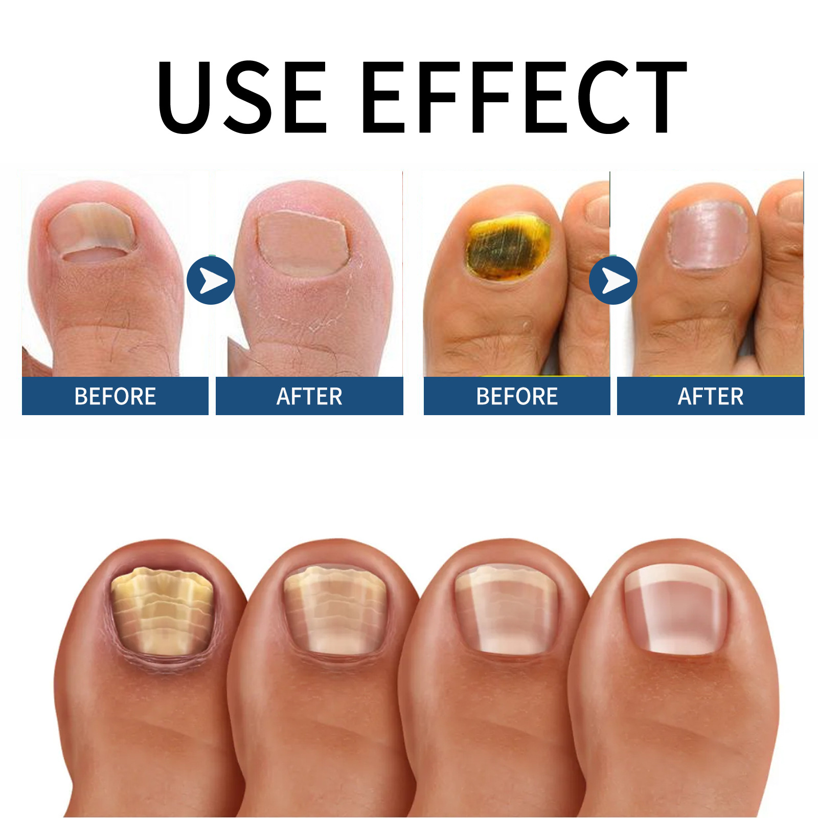 EELHOE gel Repair Hand, Foot, Grey Groin, Soft Nail, Moisturizing and Shining Nail Care_voghion.com