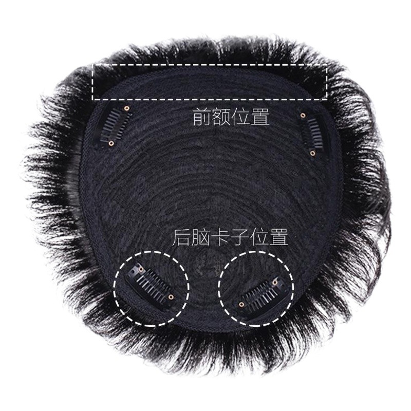 Pieza de reemplazo de cabello para hombres cubierta de la peluca cabeza reemplazo de cabello frente almohadilla de reemplazo de cabello Calvo extensión de cabello Flip peluca pelo real bloque de cabello de los hombres