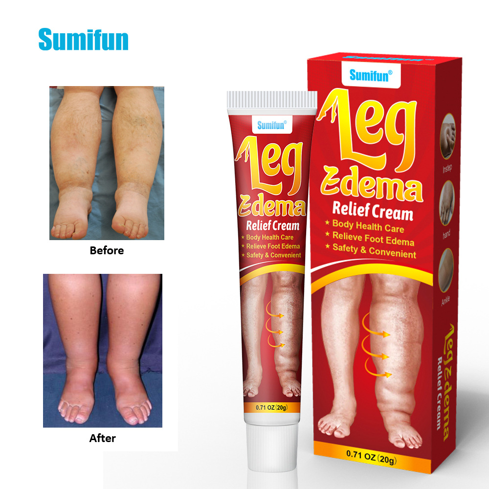 Sumifun krim anti edema K10162, krim pijat penopang otot edema, lintas batas perdagangan asing K10162