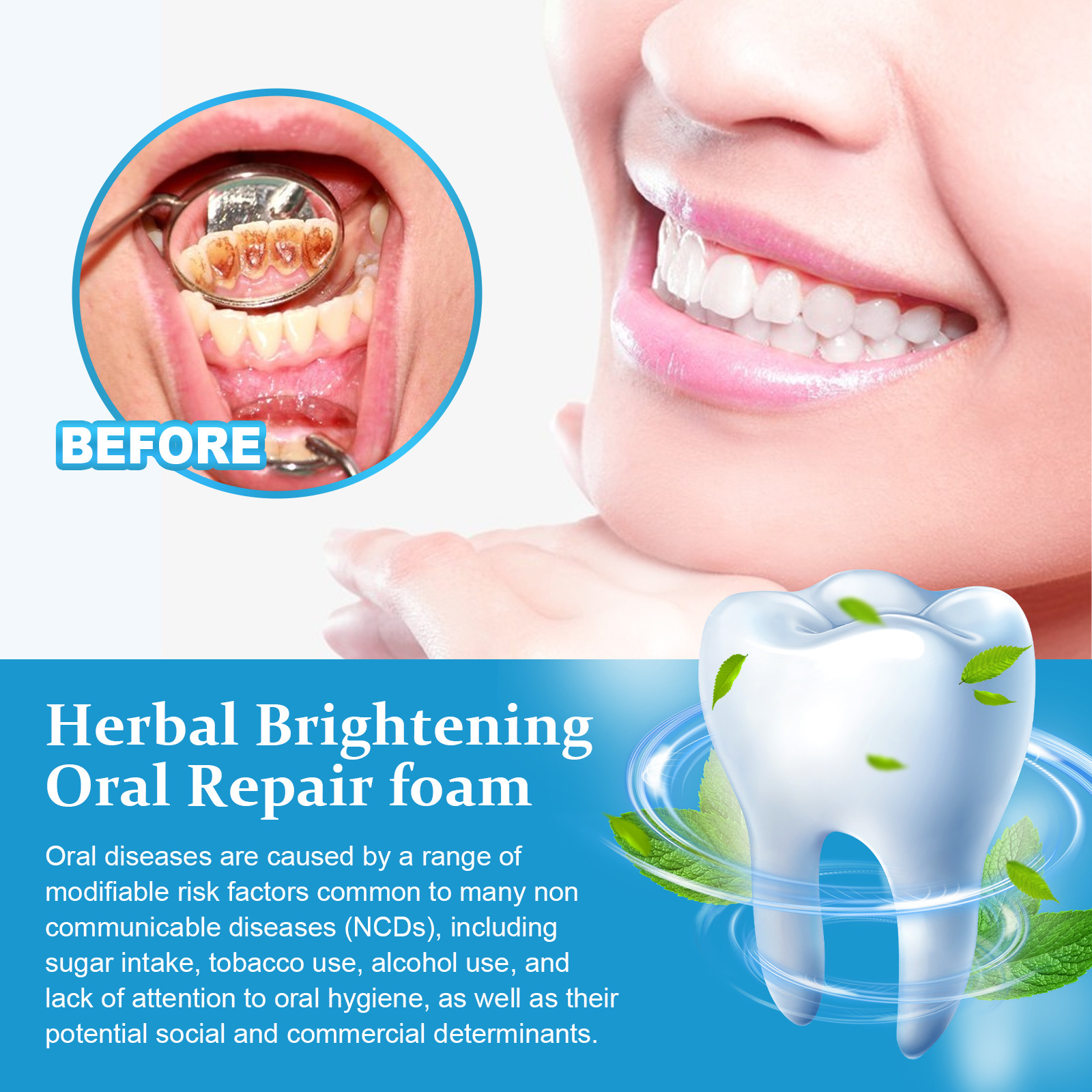 Herbal Toothpaste Mousse For Teeth Whitening And Oral Cleansing_voghion.com