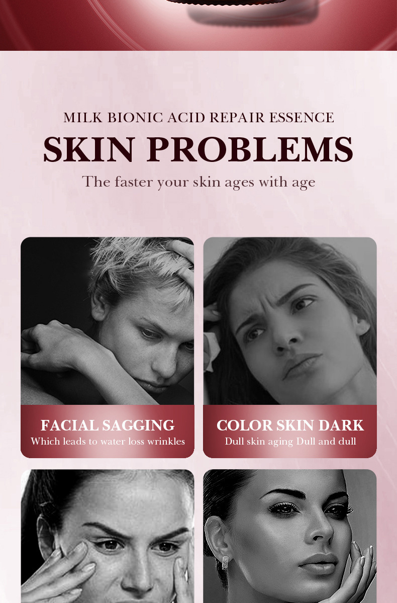 Acid SADOER Pienskābe, saraušanās, labošanas essence, pinnes noņemšana, melngalvju novēršana, poras rupji._voghion.com