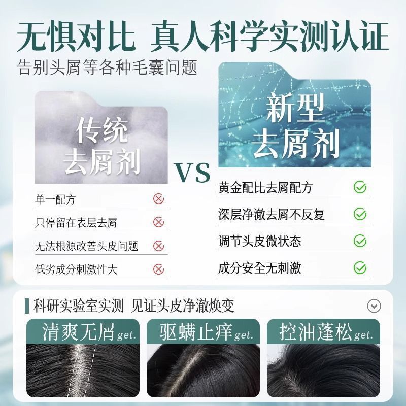 【自然で心地よい香り】Ruyi 二硫化セレン シャンプー オイルコントロール ふわふわ フケ防止 かゆみ止め ディープクレンジング|undefined
