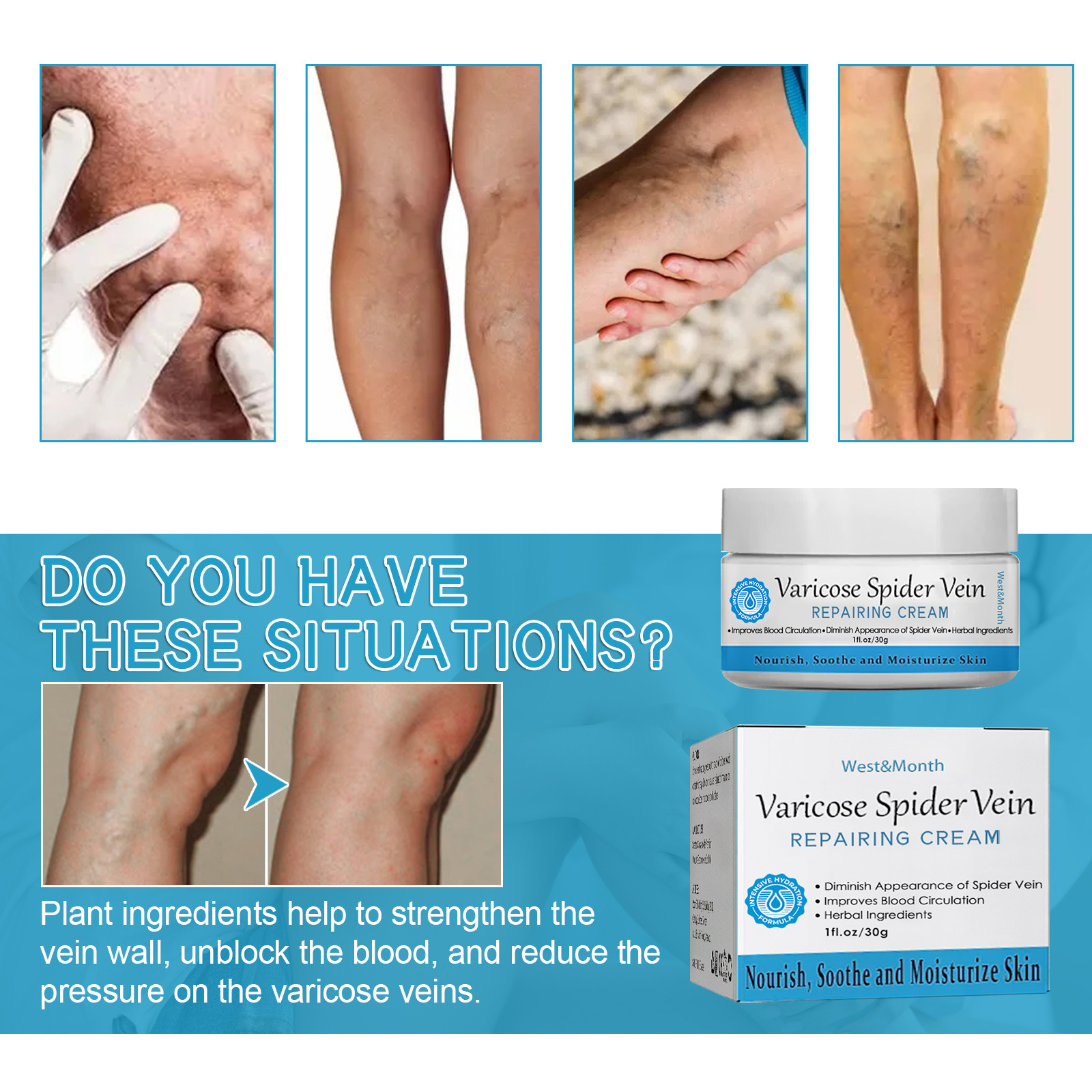 Lindert West&Month Repair Pain Regenwurm Bein prall gefüllte Venenpflege-Massagecreme_voghion.com
