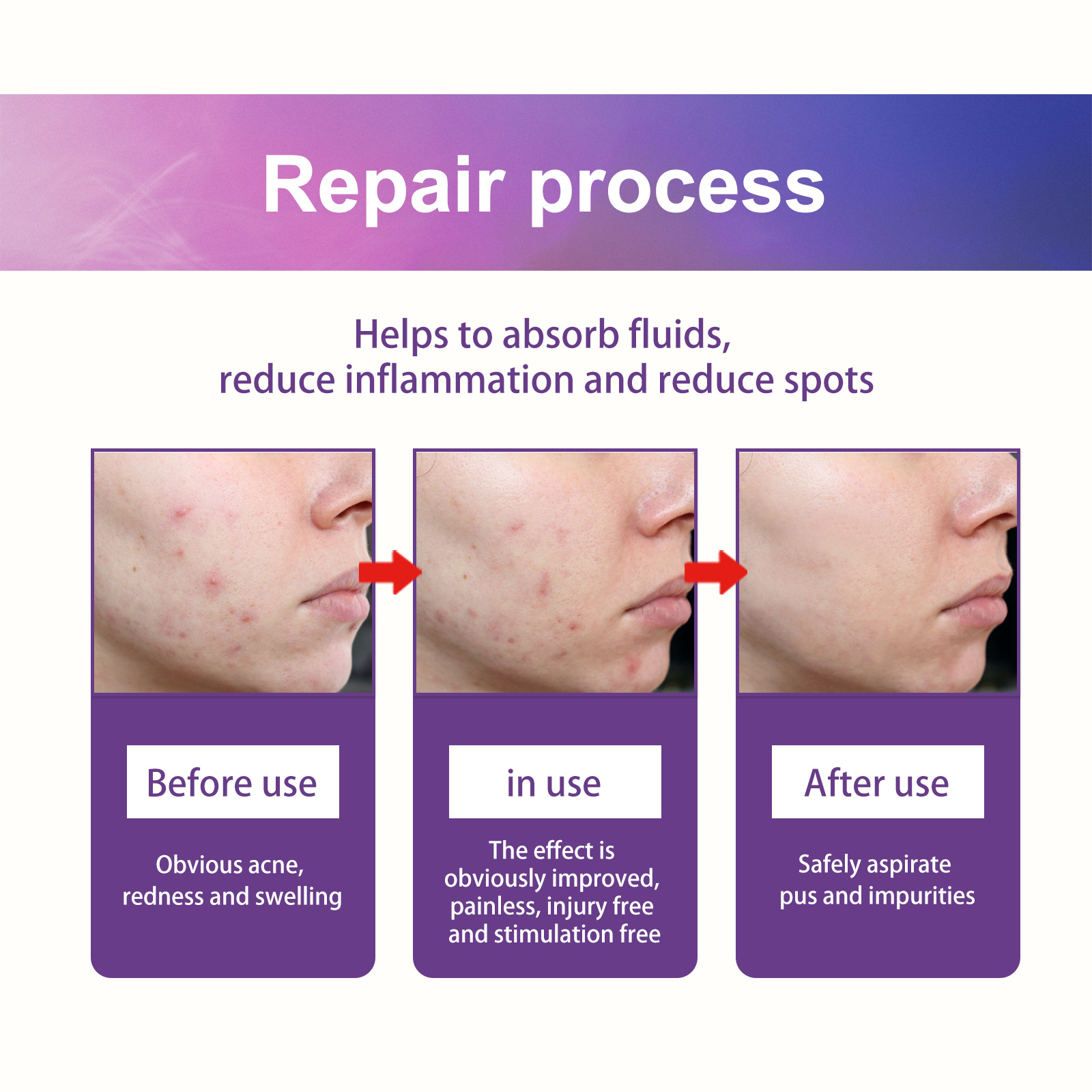 Patch hydrogel acné jaysuing pour atténuer les taches et boutons_voghion.com