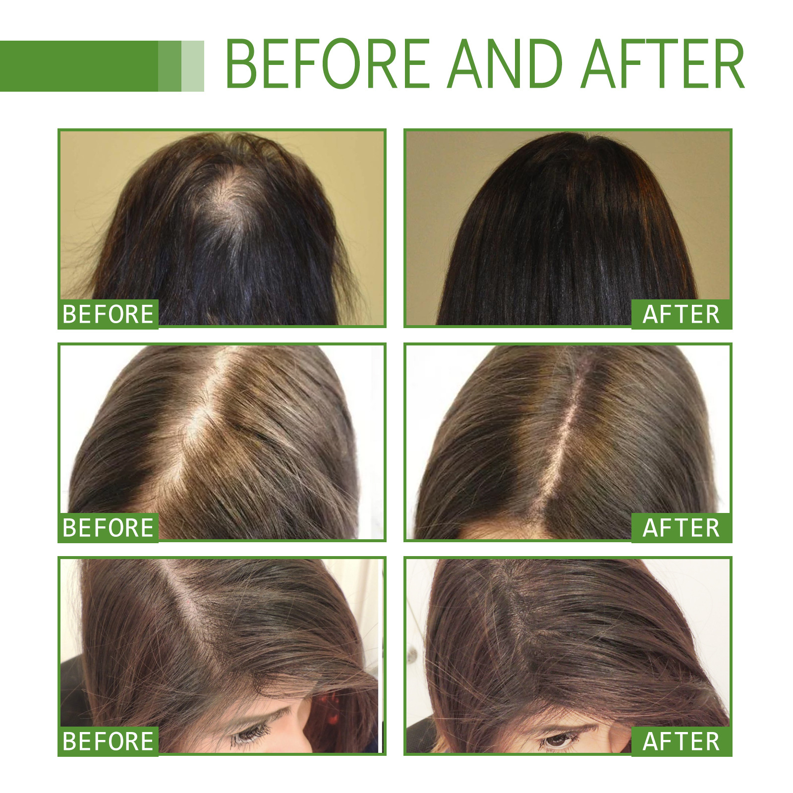 Répare les cheveux secs et endommagés du mois, hydrate les cheveux épais et denses, prévient la perte et fixe l'huile d'essence des cheveux_voghion.com