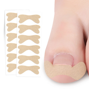 Glue-free nail paste to improve toe embedded nail groove to correct nail roll toe paste is simple and practical