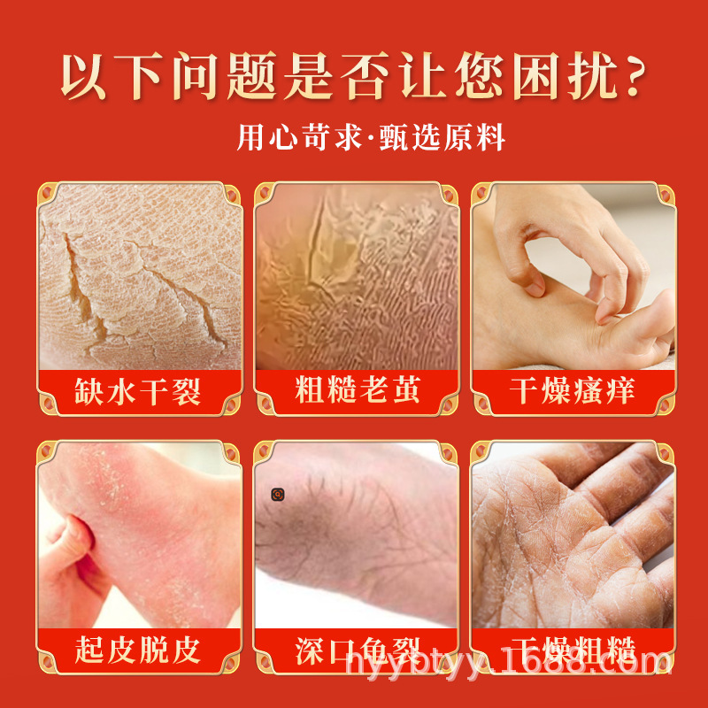 香港大药房皲裂王皲裂膏脚后跟龟裂干手足润护脚裂手裂膏滋润保湿|undefined