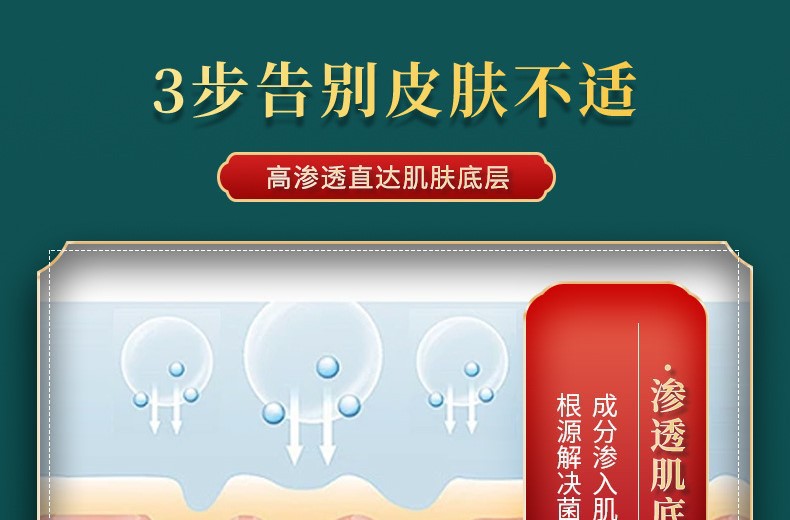 Five-Toxin Anti-Itch Cream, Plant-Based Mosquito Bite Cream, Dry Cracked Skin Itching Cream, Peeling Soothing Cream, Anti-Itch Herbal Antibacterial Cream detail image