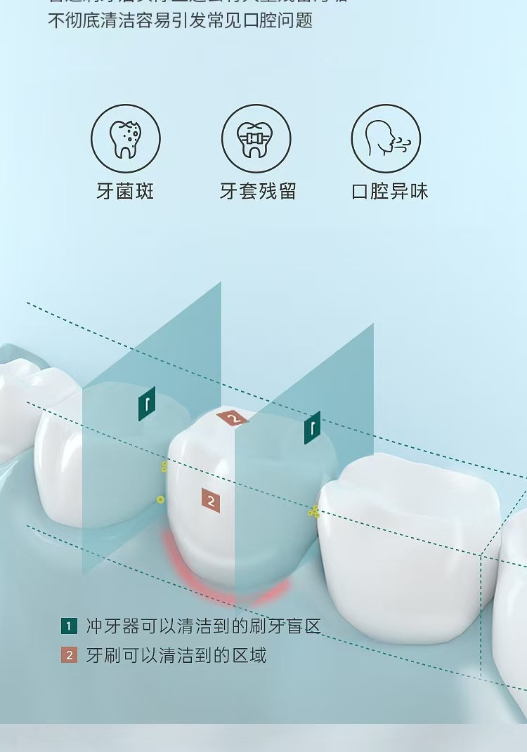 洗牙冲牙器