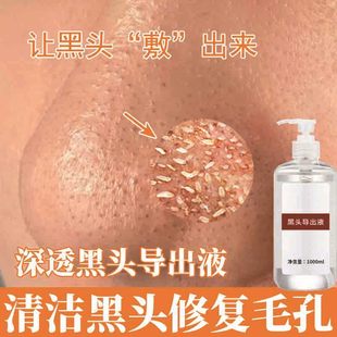 Blackhead Lead Liquid Hospital Line Small Bubble Gentle Blackhead Whitehead Acne Closed Blackhead Beauty Salon Special