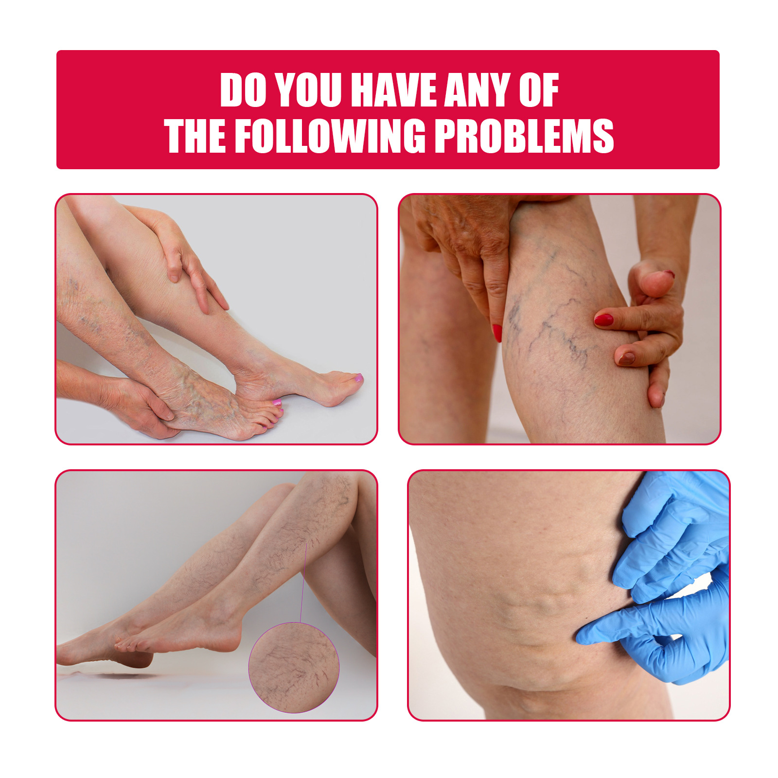 EELHOE roosiveenihooldus eeterlik õli jalamassaaž veenilaiendid parandab vereringet lümfiringe jalgade hooldus_voghion.com