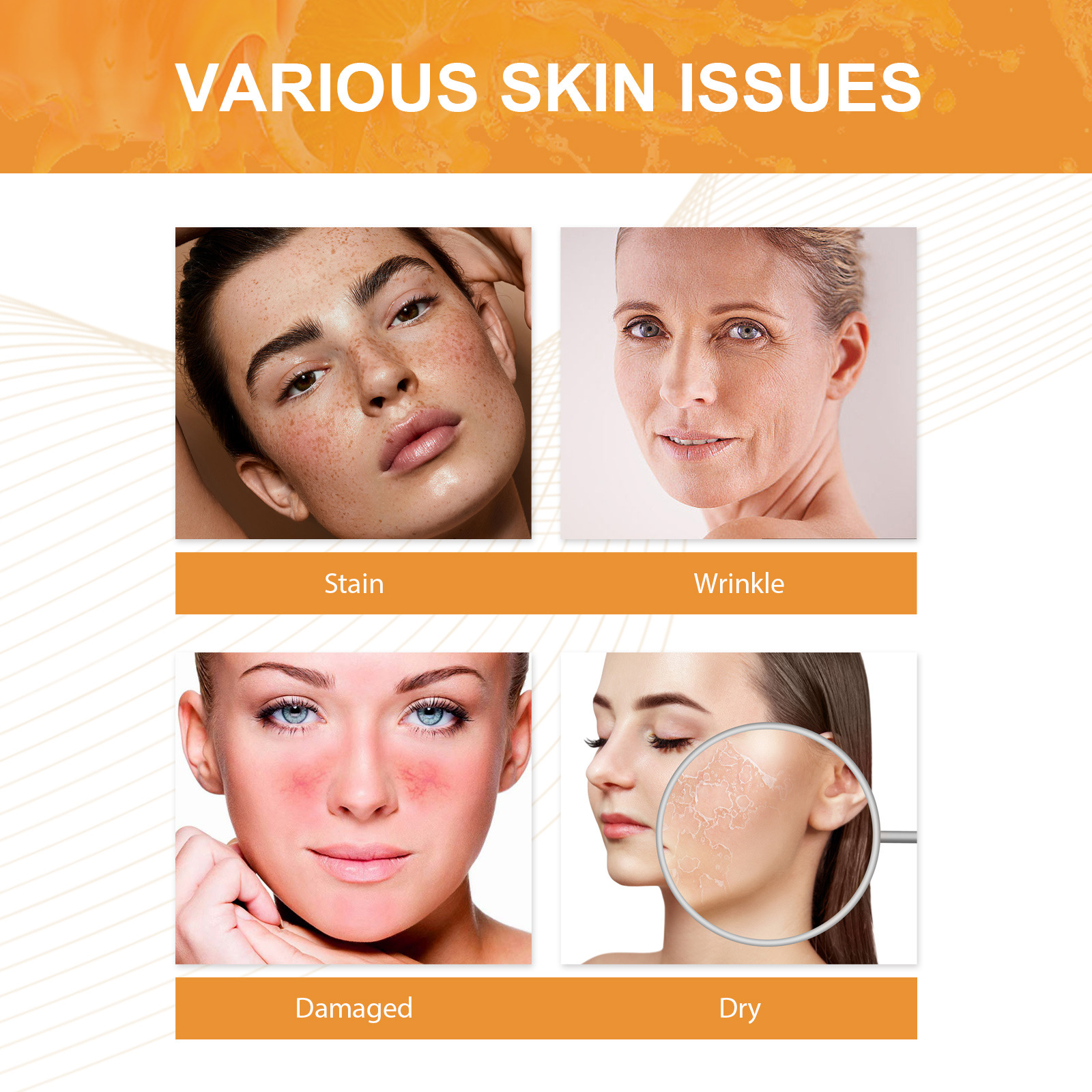 L'essence EELHOE vitamine C + vitamine E peut affaiblir les ridules, hydrater, éclaircir le teint, réparer la peau terne_voghion.com