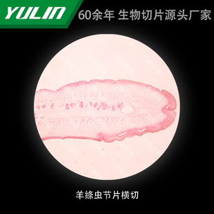 Sheepworm Joint Section Cross-cut College Medical Academy School Tissue Disease Marble Wax Slide Specimen Microscope