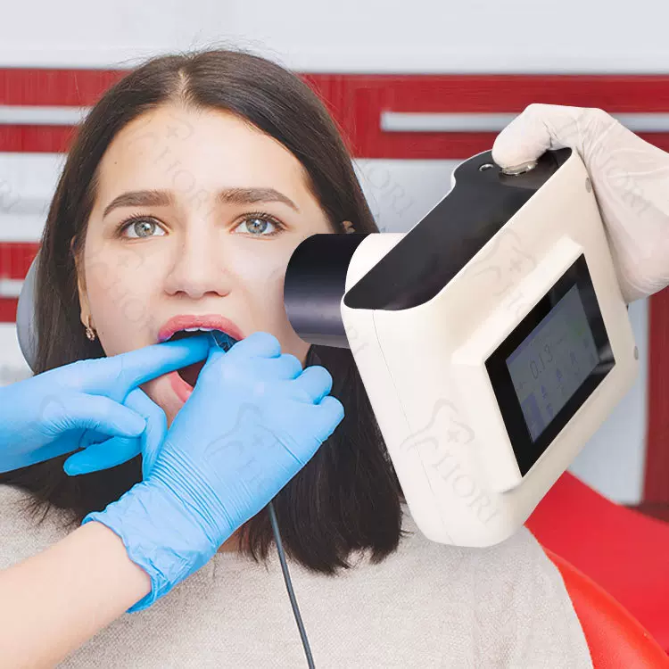 口腔便携式X光机 Dental X-ray 牙科X射线机手持式拍片机