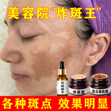无尴尬期祛斑精华液祛黄褐斑雀斑老年斑抑制黑色素美白美容院专用