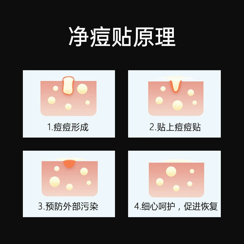 Cartoon cute acne patch, conceals acne, (Cross-border trading), Aliexpress