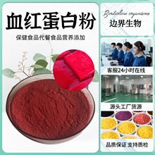 Ѫ�t���׷�70%-90% �iѪ�t���� ţѪ�t���� Ѫ�t���׷� ߅������
