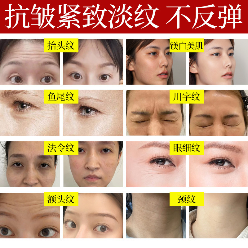 ポリペプチド抗シワクリームポリペプチド抗シワ精華液淡法令紋が引き締まっています。|undefined