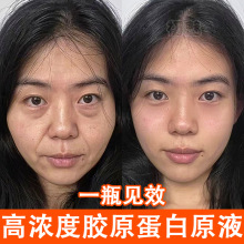 胶原蛋白三类重组原液提拉紧致去皱去法令纹填充凹陷抗皱精华液